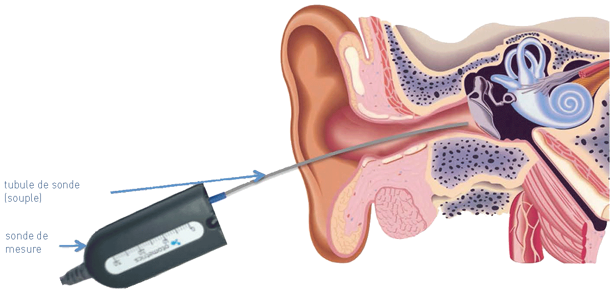 Le réglage de vos appareils auditif grâce à la mesure in-vivo.